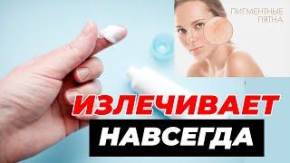 ЛУЧШИЙ крем ОТ ПИГМЕНТНЫХ ПЯТЕН и ОТБЕЛИВАНИЯ кожи. Пигментные пятна на лице как избавиться