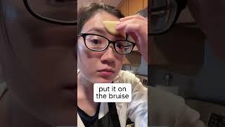Got a bruise? Try this #chinesemedicine #traditionalchinesemedicine #tcm #bruise #bruises