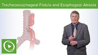 Tracheoesophageal Fistula and Esophageal Atresia | Lecturio Medical