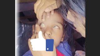 lens lagane ka tarika / how to apply eye lens , Reema yadav,/all in one reema yadav 