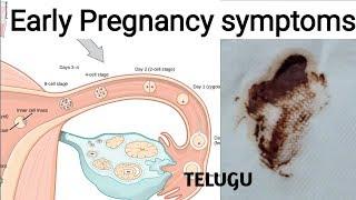 Telugu Pregnancy Symptoms | signs of Pregnancy