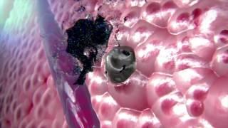 VolitionRx: Blood tests for cancers