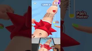 Acne Runner 3D Level-9 #shorts #game #viral