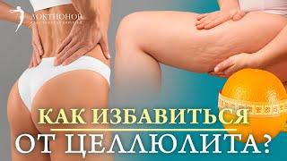 ЦЕЛЛЮЛИТ! Почему появляется и КАК ИЗБАВИТЬСЯ? Все про целлюлит за 12 минут. Ответы на вопросы