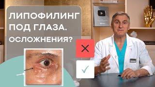 ЛИПОФИЛИНГ ПОД ГЛАЗА  УБРАТЬ СИНЯКИ ПОД ГЛАЗАМИ   ЕСТЬ ЛИ ОСЛОЖНЕНИЯ?