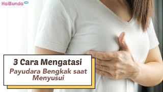 3 Cara Mengatasi Payudara Bengkak saat Menyusui