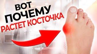 Выпирающая косточка на ноге (Hallux valgus) | Причины и лечение