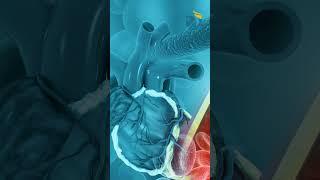 Get a detailed understanding of the EECP procedure here!
