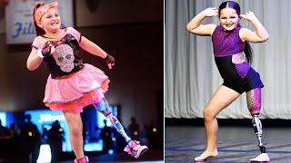 8-Year-Old Dances With Prosthetic Leg