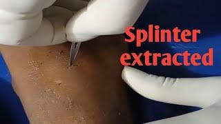 Master splinter  || Removed || #whatilearntoday || شظية
