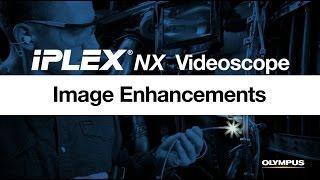 Image Enhancements Using the IPLEX® NX Videoscope