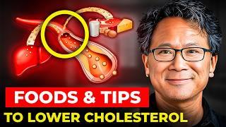 Dr. William Li's SHOCKING Tips to Lower Cholesterol! Foods You Need to Know!