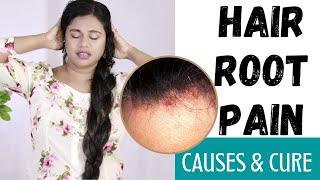 Hair Root Pain Explained | Feeling Pain,Tingling Sensation In Hair Roots? WATCH THIS