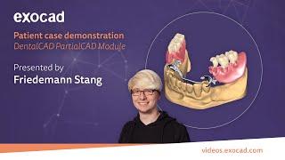 Patient Case Demonstration(3/6): DentalCAD PartialCAD Module