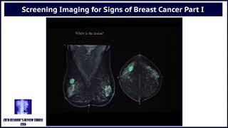 Screening Imaging for Signs of Breast Cancer - Part I