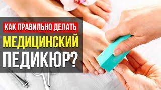 МЕДИЦИНСКИЙ ПЕДИКЮР! ВСЯ ВАЖНАЯ ИНФОРМАЦИЯ: КАК ОН ПРАВИЛЬНО ДЕЛАЕТСЯ И ЧЕМ ОТЛИЧАЕТСЯ ОТ ОБЫЧНОГО