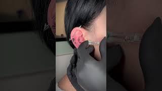 OMG! TRIPLE CONCH PIERCING 