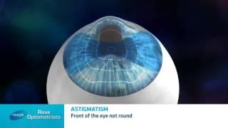 What is astigmatism? - Rose Optometrists explain