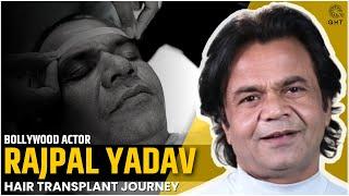 Rajpal Yadav | Bollywood Actor Hair Transplant Journey at QHT Regrow Clinic Haridwar