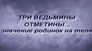 ТРИ ВЕДЬМИНЫ ОТМЕТИНЫ... ЗНАЧЕНИЕ РОДИНОК НА ТЕЛЕ.