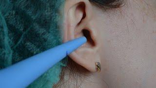 Серная пробка. Удаление  в домашних условиях. Ear wax  Removal at home