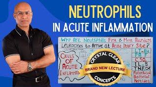 Neutrophils in Acute Injury | Hematology | Pathology