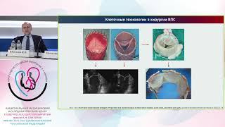 Врожденные пороки сердца: современные тенденции хирургического лечения