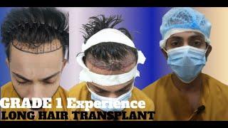 Hair Transplant in bhopal | Best Results & Cost of Hair Transplant in bhopal