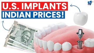 Available Now - Nobel Biocare Dental Implants in Chandigarh, India