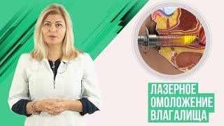 Лазерное омоложение влагалища при сухости и зуде влагалища, при недержании мочи