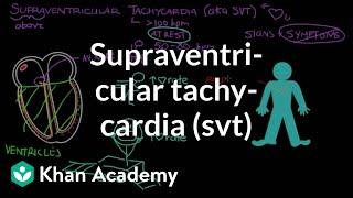 Supraventricular tachycardia (SVT) | Circulatory System and Disease | NCLEX-RN | Khan Academy