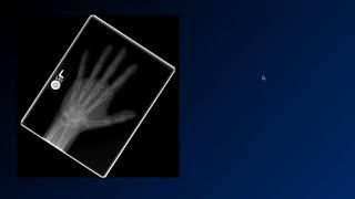 Basic Neuroradiology - Chapter 3 - History is important