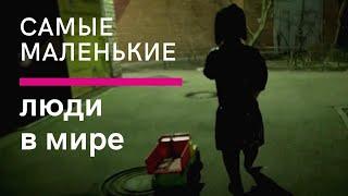 Самые маленькие люди в мире. Ахондроплазия