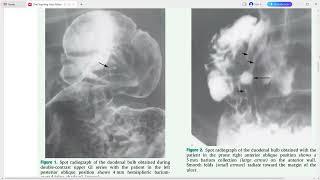 GIT IMAGING THE TEACHING FILES SERIES