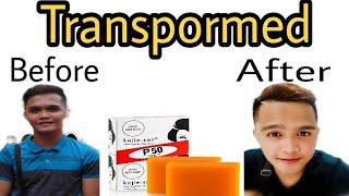 How To Use Kojie San intense Whitening Soap Part 1|Ako si MD vlogs