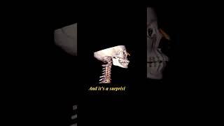 Ancient Brain Surgery? The Mystery of the Peruvian Skull with a Metal Implant