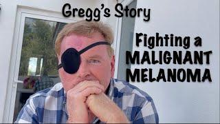 FIGHTING A MALIGNANT MELANOMA / GREGG'S STORY