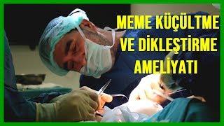 Meme Küçültme ve Dikleştirme Ameliyatı (CANLI ANLATIM)