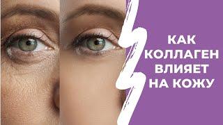 Коллаген для кожи: как коллаген влияет на кожу.