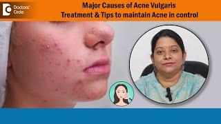 How to Treat Acne Vulgaris on face?  Tips to keep Acne in control - Dr.Vani Yepuri | Doctors' Circle