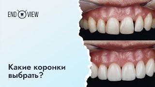 Коронки на передние зубы: какие лучше?