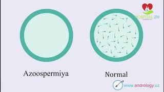 3 Spermatozoidlar bo'lmasligi Azoospermiya #Spermogramma tahlili