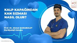 Kalp Kapağından Kan Sızması Nasıl Olur? - Prof. Dr. Ahmet Karabulut