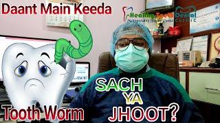 Daant Main Keeda | Tooth Worm I Dental caries #teeth