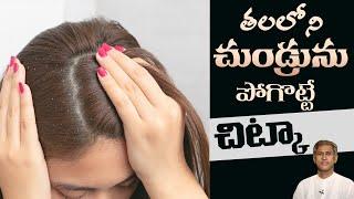 #HomeRemedy for #Dandruff | Hair Care Tips | #ManthenaSatyanarayanaRajuVideos