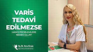 Varis Tedavi Edilmezse Ne Olur? | Op. Dr. Arzu Ercan