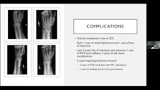 ORIG Journal Club -  Distal Radius Fractures