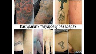 Как удалить татуировку без вреда - особенности видов и фото для сайта tatufoto.com