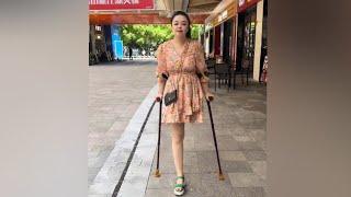 Beautiful woman with amputated leg walking with crutches #amputee