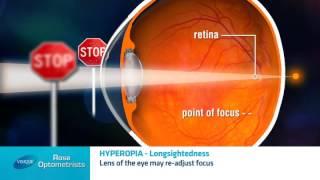 What is Long-Sightedness? All longsighted people have multiple options - Rose Optometrists explain